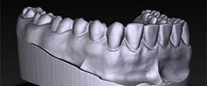 Medical Applications in 3D Scanning